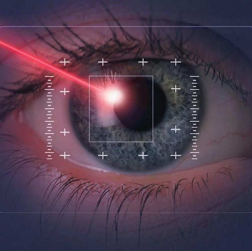 Как лазерная коррекция зрения помогает вернуть четкость и комфорт в повседневную жизнь